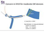[EuroPCR 2012]IVUS：评估中等程度的左主干病变的最佳选择
