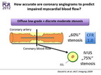 [EuroPCR 2012]非侵入方法联合的解剖学和功能评估的作用